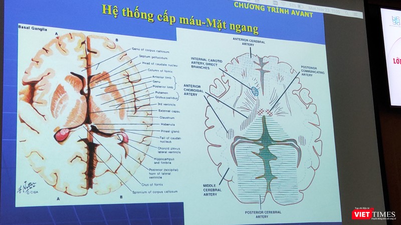 Hình ảnh phân tich hệ thống cấp máu - mặt ngang (Ảnh: Hoà Bình) Hình ảnh phân tich hệ thống cấp máu - mặt ngang (Ảnh: Hoà Bình)