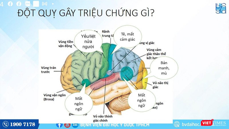 BS Thắng phân tích về các hậu quả nặng nề của bệnh đột quỵ (Ảnh: BVCC) BS Thắng phân tích về các hậu quả nặng nề của bệnh đột quỵ (Ảnh: BVCC)