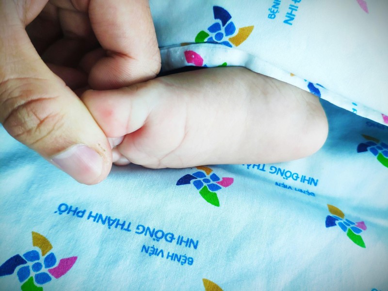 Bé gái 6 tháng tuổi chỉ có một nốt hồng duy nhất trên chân Bé gái 6 tháng tuổi chỉ có một nốt hồng duy nhất trên chân