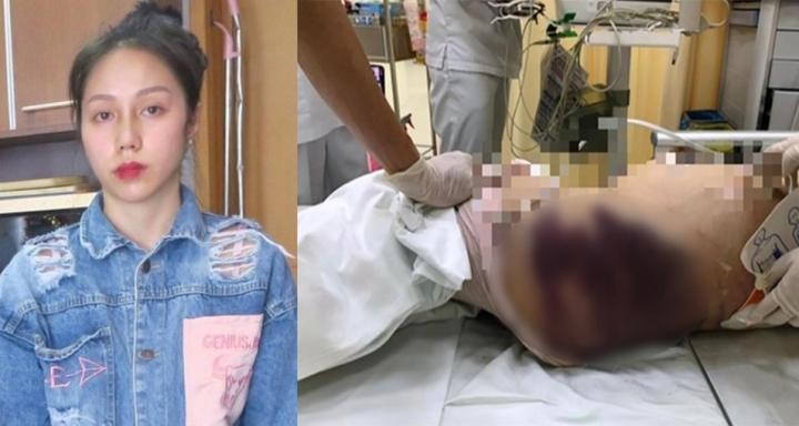 "Dì ghẻ" Nguyễn Võ Quỳnh Trang hành hạ bé gái 8 tuổi tới chết bị khởi tố bổ sung tội danh giết người "Dì ghẻ" Nguyễn Võ Quỳnh Trang hành hạ bé gái 8 tuổi tới chết bị khởi tố bổ sung tội danh giết người