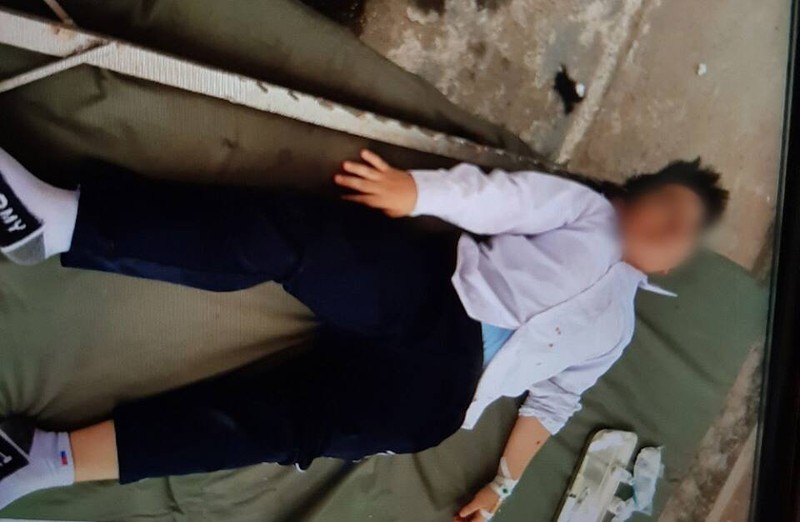 S. gặp tai nạn khi đang học nhảy cao ở trường S. gặp tai nạn khi đang học nhảy cao ở trường