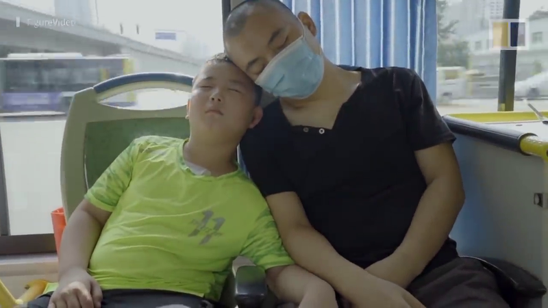 Bệnh viện Nhi đồng 1 TP.HCM mổ tách thành công cặp song sinh dính liền gan nhỏ nhất ảnh 6 Hành trình cứu bố ung thư máu của cậu bé Trung Quốc 11 tuổi