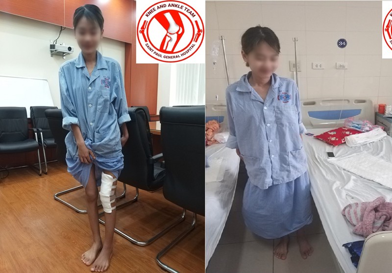 Nữ sinh U. đứng, tập đi lại sau khi được phẫu thuật. Nữ sinh U. đứng, tập đi lại sau khi được phẫu thuật.