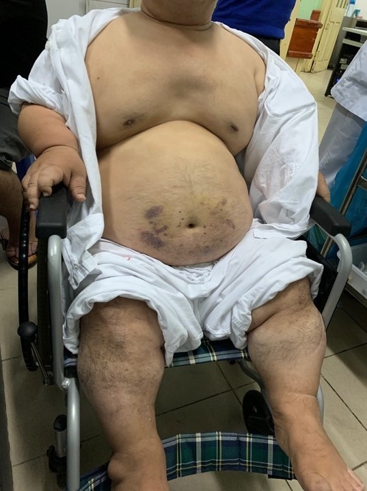 Tình trạng bệnh nhân trước khi mổ (Ảnh: BVCC) Tình trạng bệnh nhân trước khi mổ (Ảnh: BVCC)