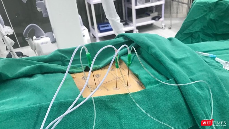 Bệnh nhân thực hiện thủ thuật tiêm cột sống (Ảnh: BVCC) Bệnh nhân thực hiện thủ thuật tiêm cột sống (Ảnh: BVCC)