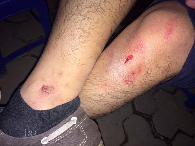 Hà Nội: Dầm thép khổng lồ bất ngờ đổ sập giữa đường ảnh 1