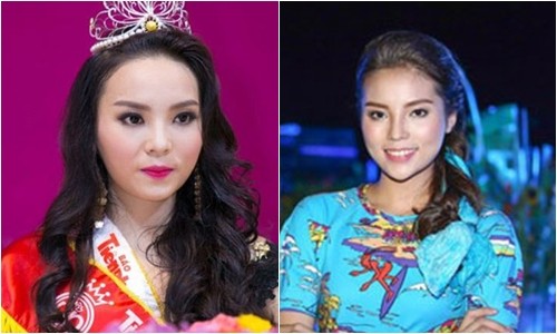 Hoa hậu Kỳ Duyên bị thẩm mỹ viện "tố" dùng dao kéo ảnh 3