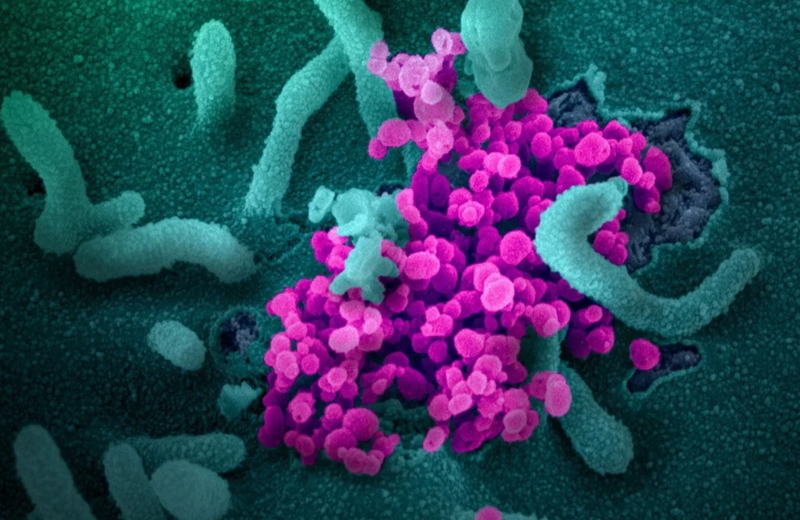 Một quan chức cho rằng các bên thù địch có thể không cần chỉnh sửa virus corona chủng mới, bởi điều đó để lại dấu vết (Ảnh: EPA) Một quan chức cho rằng các bên thù địch có thể không cần chỉnh sửa virus corona chủng mới, bởi điều đó để lại dấu vết (Ảnh: EPA)