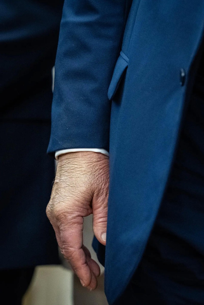 Lớp trang điểm trên bàn tay phải của Tổng thống Trump gây chú ý khi ông đưa ra thông báo tại Phòng Bầu dục trong hôm 2/9. Ảnh: NYTimes. Sức khỏe của ông Trump và làn sóng tin đồn gây bão trên mạng xã hội 2.jpg