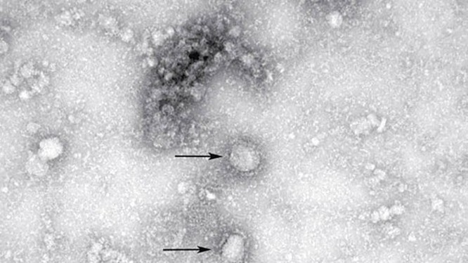 Hình ảnh virus corona chủng mới dưới ống kính hiển vi (Ảnh: Đông Phương) Hình ảnh virus corona chủng mới dưới ống kính hiển vi (Ảnh: Đông Phương)