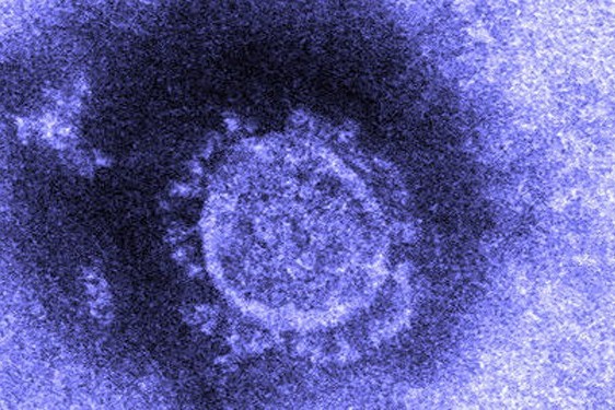 Virus Corona. (Ảnh: Jiji Press) Virus Corona. (Ảnh: Jiji Press)