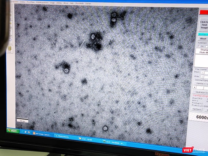 Virus Corona đã được phân lập. Ảnh: Minh Thúy