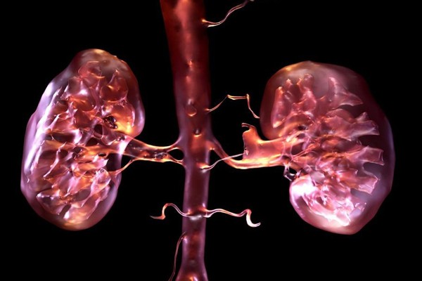 Hội chứng thận hư thực chất là một bệnh mạn tính. Ảnh: Internet Hội chứng thận hư thực chất là một bệnh mạn tính. Ảnh: Internet