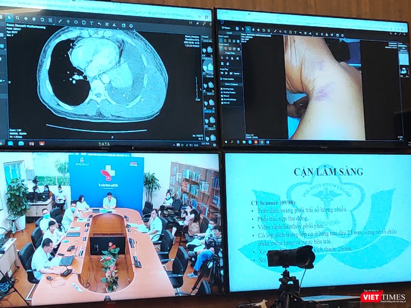 Các bác sĩ tại Bệnh viện Đại học Y Hà Nội hội chẩn các bệnh nhân mắc bệnh mãn tính, có tình trạng bệnh nặng (Ảnh: Minh Thúy) Các bác sĩ tại Bệnh viện Đại học Y Hà Nội hội chẩn các bệnh nhân mắc bệnh mãn tính, có tình trạng bệnh nặng (Ảnh: Minh Thúy)