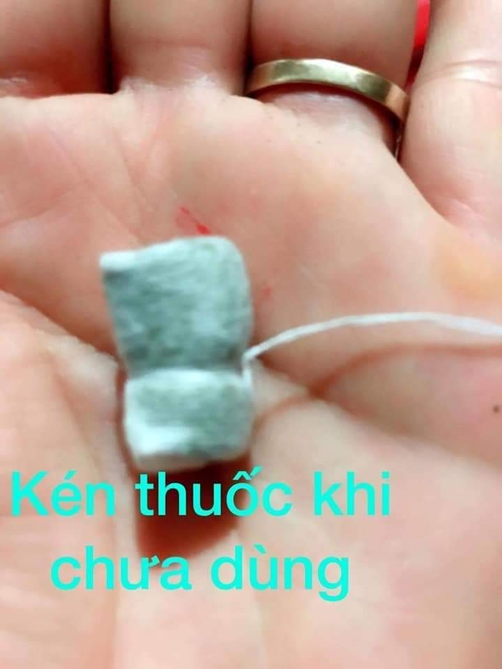 Kén thuốc khi chưa dùng (Ảnh: FB H.T)