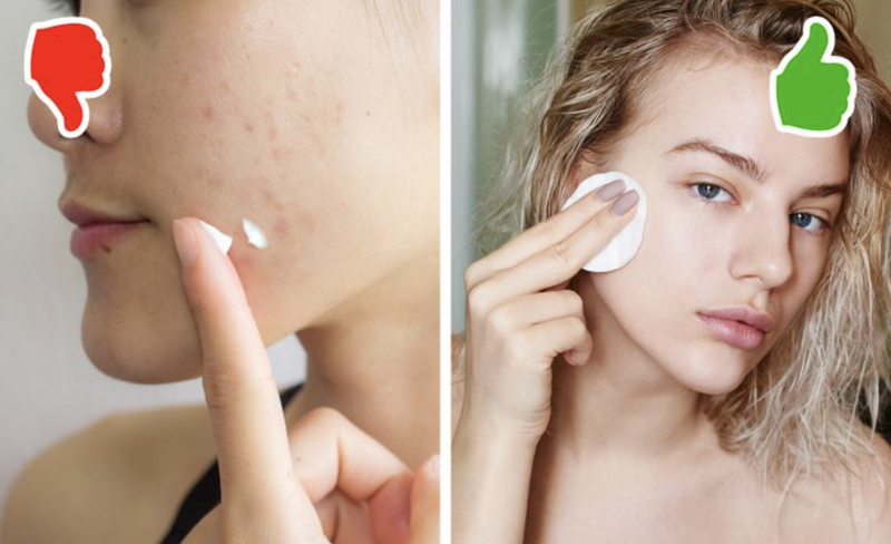 Bôi kem đánh răng lên da có thể gây kích ứng (Ảnh: BrightSide)