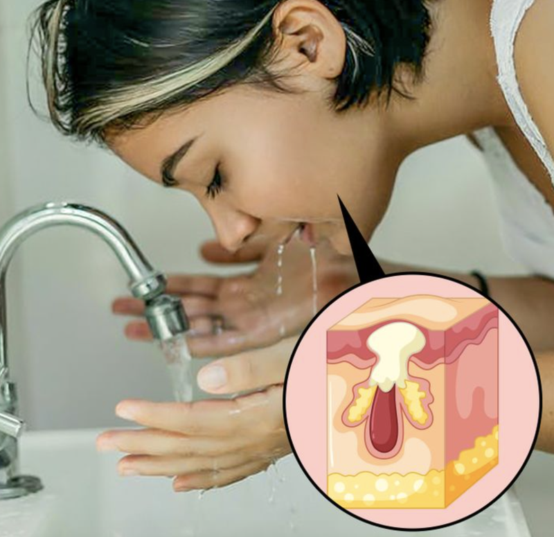 Không nên rửa mặt liên tục (Ảnh: BrightSide)