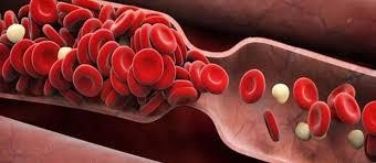 Tắc nghẽn mạch máu (Ảnh minh hoạ)