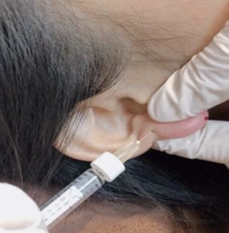 Làm dáng "tai phật" tiềm ẩn nhiều hậu hoạ khôn lường (Ảnh minh hoạ) Làm dáng "tai phật" tiềm ẩn nhiều hậu hoạ khôn lường (Ảnh minh hoạ)