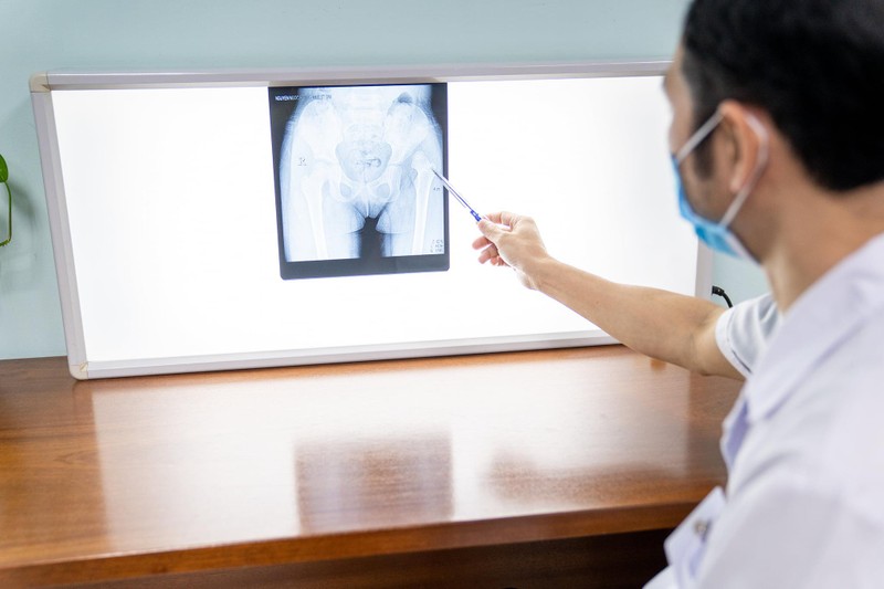 Bác sĩ xem phim chụp X-quang của trẻ (Ảnh - BVCC) Bác sĩ xem phim chụp X-quang của trẻ (Ảnh - BVCC)