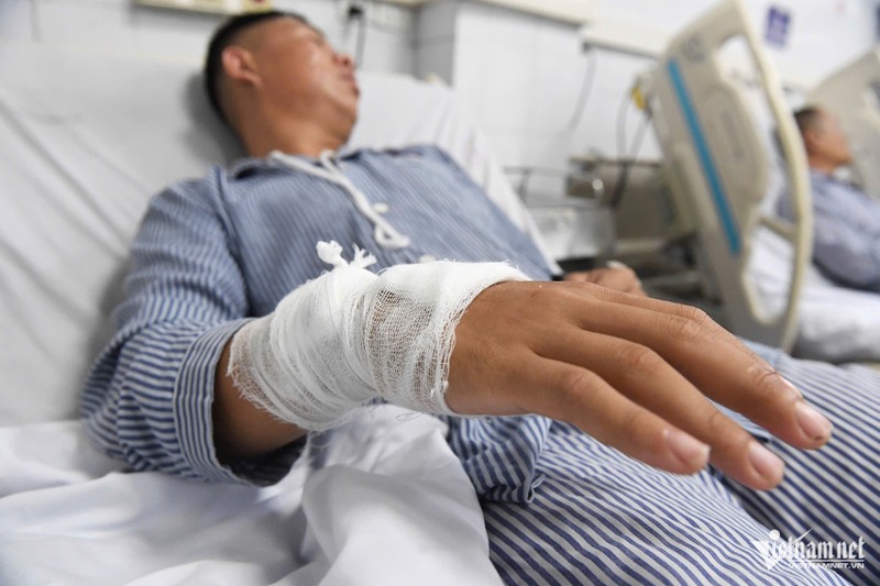 Anh Tú bị chấn thương tay sau khi thoát khỏi tàu du lịch. Ảnh: Thạch Thảo Anh 1.jpeg