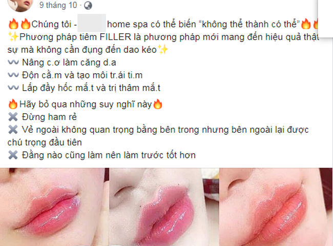 Quảng cáo tiêm filler của một spa trên địa bàn TP.HCM Quảng cáo tiêm filler của một spa trên địa bàn TP.HCM