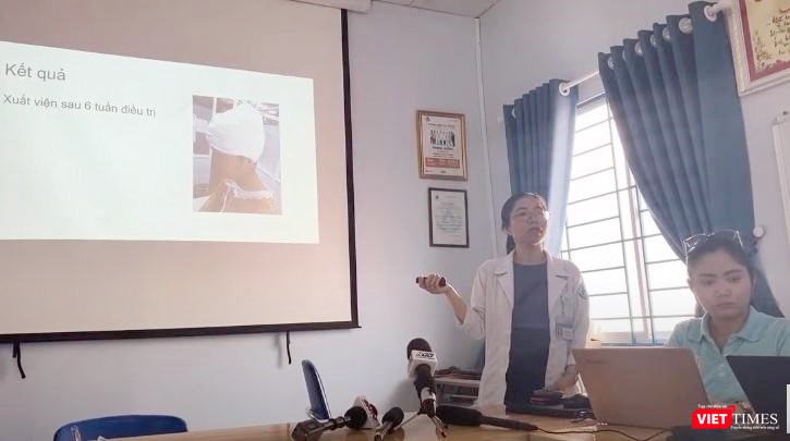 Thạc sĩ - BS Diệp Quế Trinh - Phó khoa Phỏng tạo hình (BV Nhi đồng 1 TP.HCM) chia sẻ về ca bệnh (Ảnh: Nguyễn Trăm)