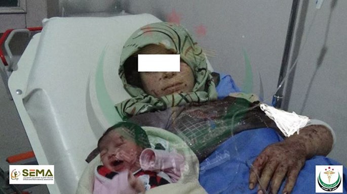 Sinh ra với mảnh đạn găm trên trán ảnh 1