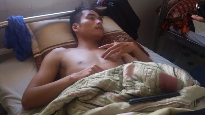 Anh Nguyễn Văn Tùng - một trong 6 nạn nhân bị xe tông nằm điều trị tại Bệnh viện Đa khoa Kon Tum. Anh Nguyễn Văn Tùng - một trong 6 nạn nhân bị xe tông nằm điều trị tại Bệnh viện Đa khoa Kon Tum.