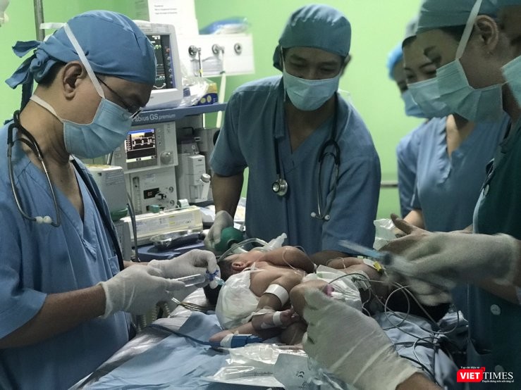Ê kíp bác sĩ BV Nhi đồng 1 thực hiện ca mổ tách hai em bé song sinh dính liền gan. Ảnh: Thùy Dương Ê kíp bác sĩ BV Nhi đồng 1 thực hiện ca mổ tách hai em bé song sinh dính liền gan. Ảnh: Thùy Dương