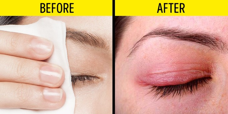 Những cách trị gàu đơn giản, ít tốn kém mà hiệu quả bất ngờ ảnh 10 8 sai lầm tai hại khi làm đẹp không phải ai cũng biết