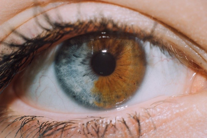 Ảnh: BrightSide Ảnh: BrightSide