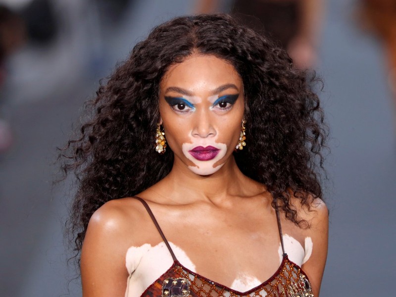 50 tấm hình có sức ảnh hưởng lớn nhất trong năm 2017 (Phần 2) ảnh 16