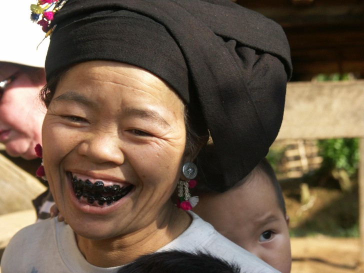 10 phương pháp làm đẹp kỳ lạ trong quá khứ ảnh 1 10 phương pháp làm đẹp kỳ lạ trong quá khứ ảnh 1