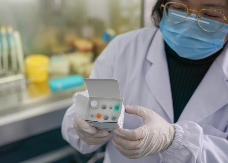 Bộ kit xét nghiệm sẽ sớm được đưa vào sử dụng để phát hiện người bị nhiễm virus corona chủng loại mới (Ảnh: Đông Phương) Bộ kit xét nghiệm sẽ sớm được đưa vào sử dụng để phát hiện người bị nhiễm virus corona chủng loại mới (Ảnh: Đông Phương)