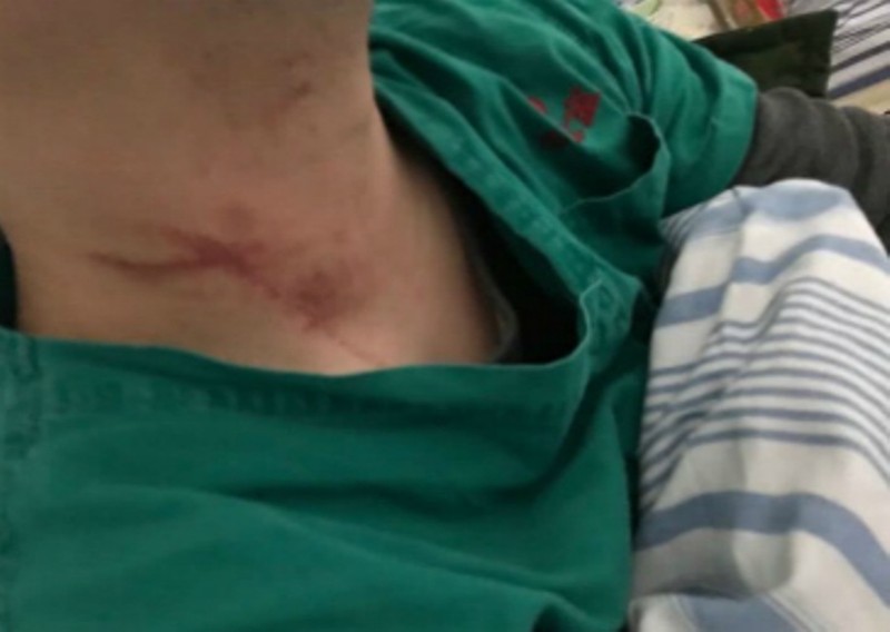 Người y tá bị người nhà bệnh nhân tấn công (Ảnh: Đông Phương).