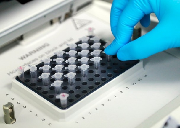 Việc nghiên cứu sản xuất vaccine đang được Trung Quốc gấp rút tiến hành và có kết quả khả quan, dự kiến đến tháng 4 sẽ được thử nghiệm lâm sàng trên người (Ảnh: Đông Phương)