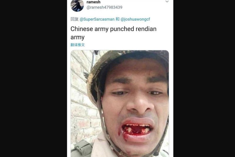 Lính Ấn Độ bị thương trong vụ xung đột hôm 15/6 (Ảnh: weibo).