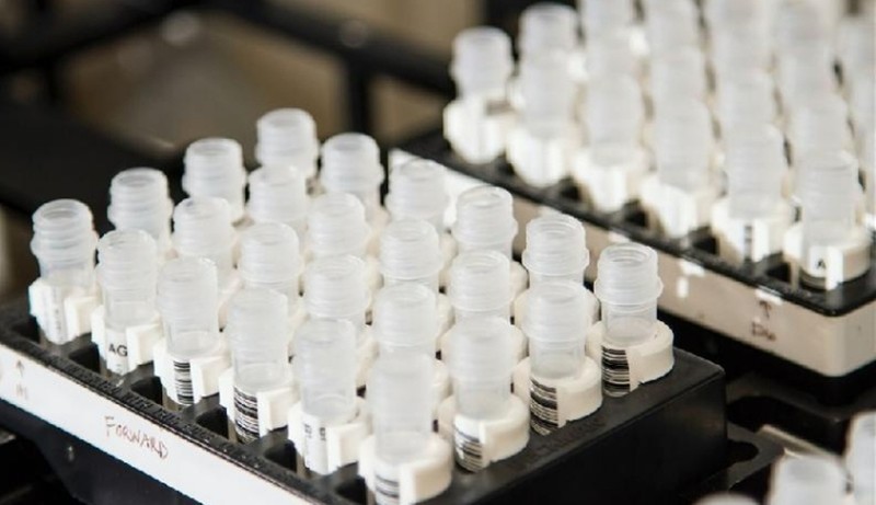 Phương pháp xét nghiệm virus corona mới qua nước bọt được coi là bước đột phá quan trọng trong cuộc chiến chống đại dịch COVID-19 (Ảnh: 6do.new).