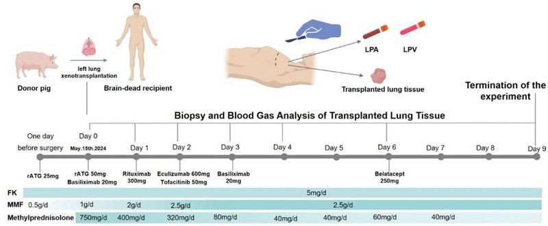 Phac do ca ghep phoi.jpg