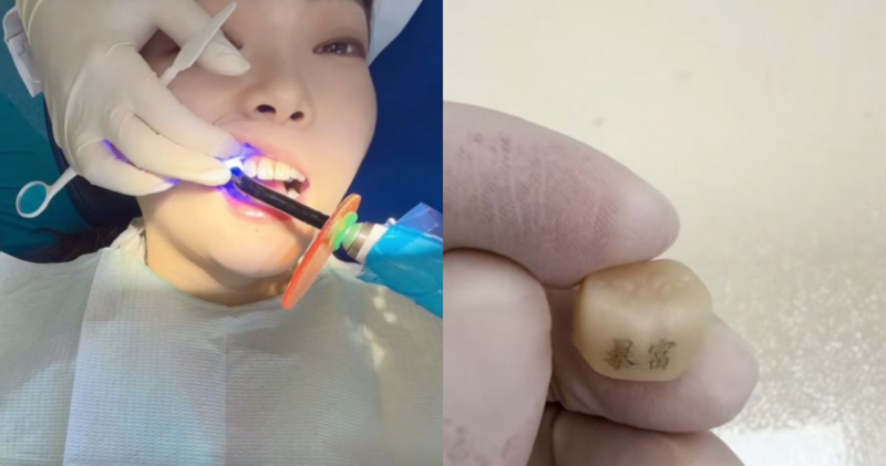 Một khách hàng trẻ đang làm thủ thuật "xăm răng" với hai chữ "Bạo phú" (Giàu nhanh). Ảnh: Orientaldaily.