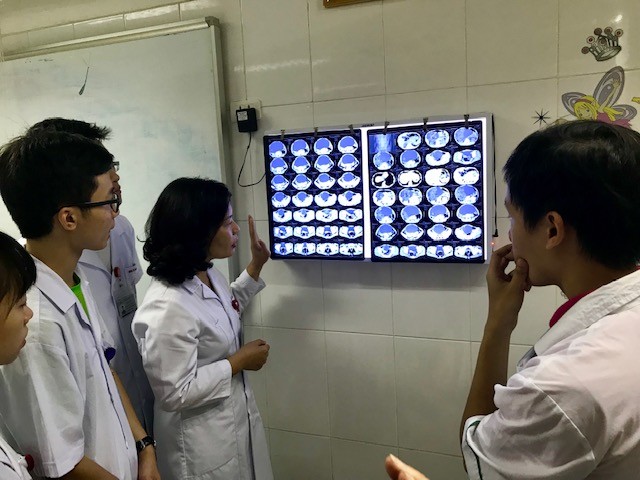 Trao đổi về phim chụp khối u quái buồng trứng của bệnh nhi