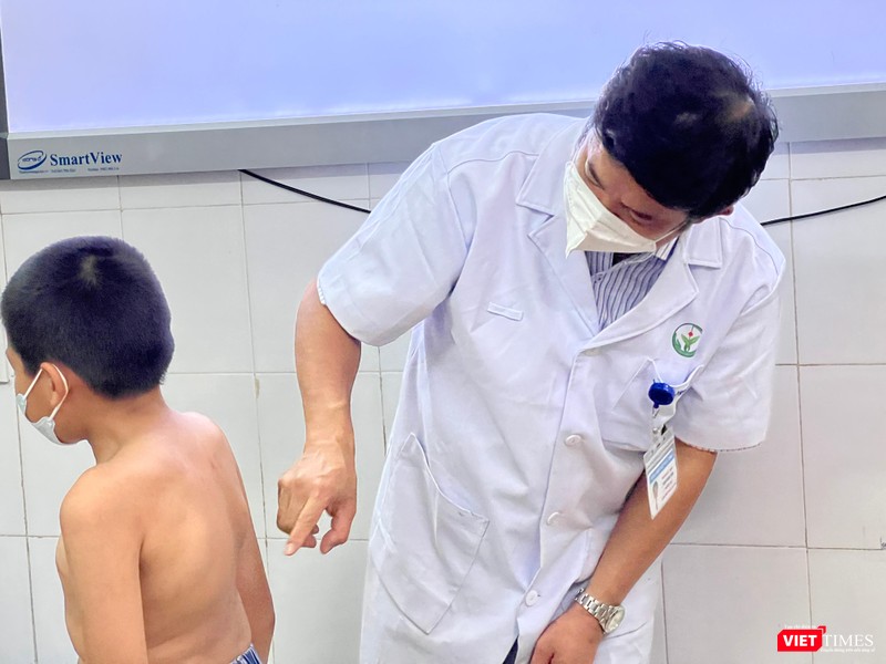 PGS.TS. Đinh Ngọc Sơn - Trưởng Khoa Phẫu thuật cột sống BV Việt Đức - khám và đưa ra hướng điều trị cho cháu bé bị cong vẹo cột sống