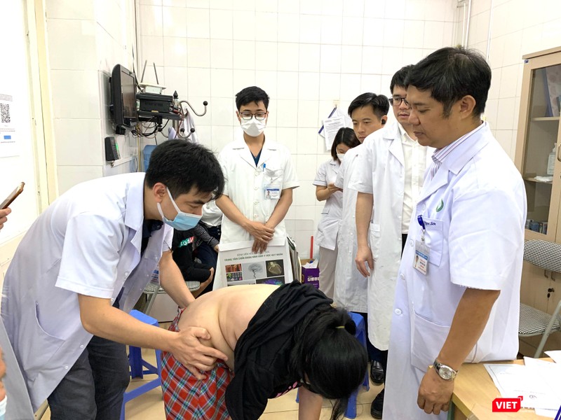 Bé Nguyễn Hà Tr. ở Bắc Ninh, 11 tuổi, bị vẹo cột sống tới 59-60 độ