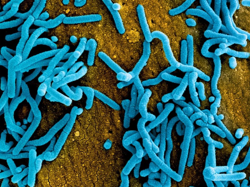 Virus Marburg có độc lực rất cao Virus Marburg có độc lực rất cao