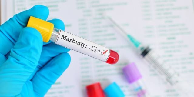 Virus Marburg khiến 9 người chết và WHO lập tức phải họp khẩn (ảnh: Bimbisaniebelli) Virus Marburg khiến 9 người chết và WHO lập tức phải họp khẩn (ảnh: Bimbisaniebelli)
