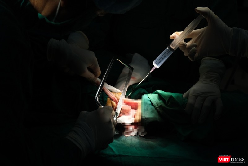 Ca phẫu thuật cho bệnh nhân biến chứng đái tháo đường nặng