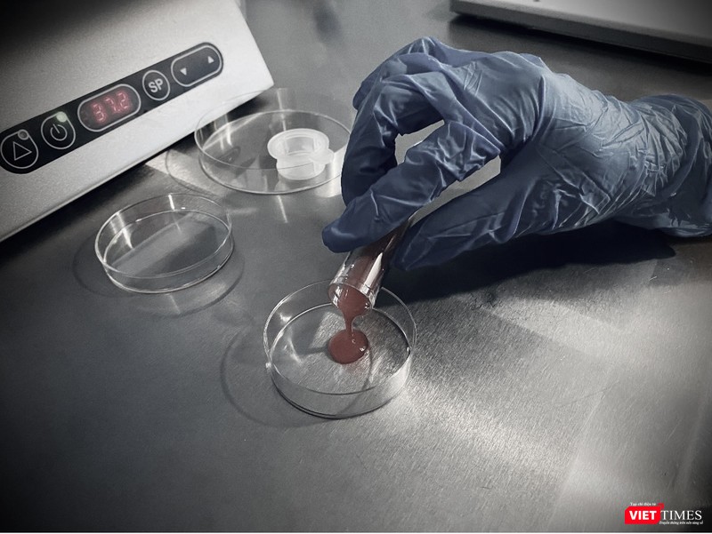 Thao tác đổ dịch nang ra đĩa để tìm cụm trứng non