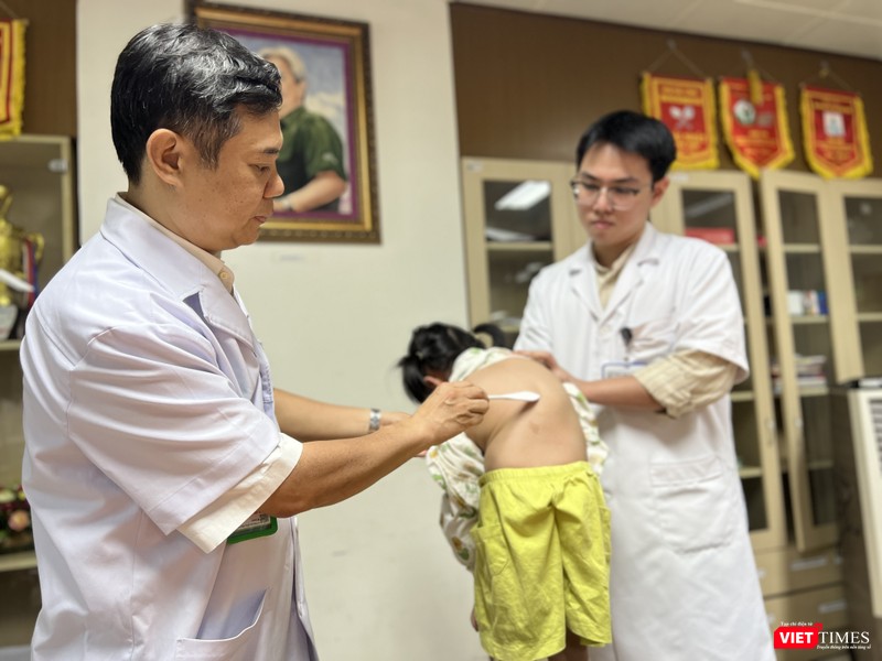 VT_vẹo bướu V.jpg