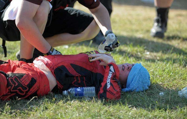 Sốc nhiệt là gì: Bạn nên sơ cứu thế nào và các biện pháp phòng tránh?